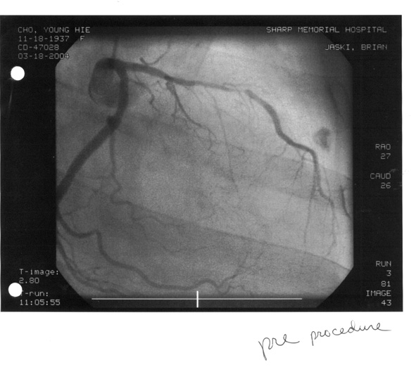 heartscan.jpg heartscan.jpg